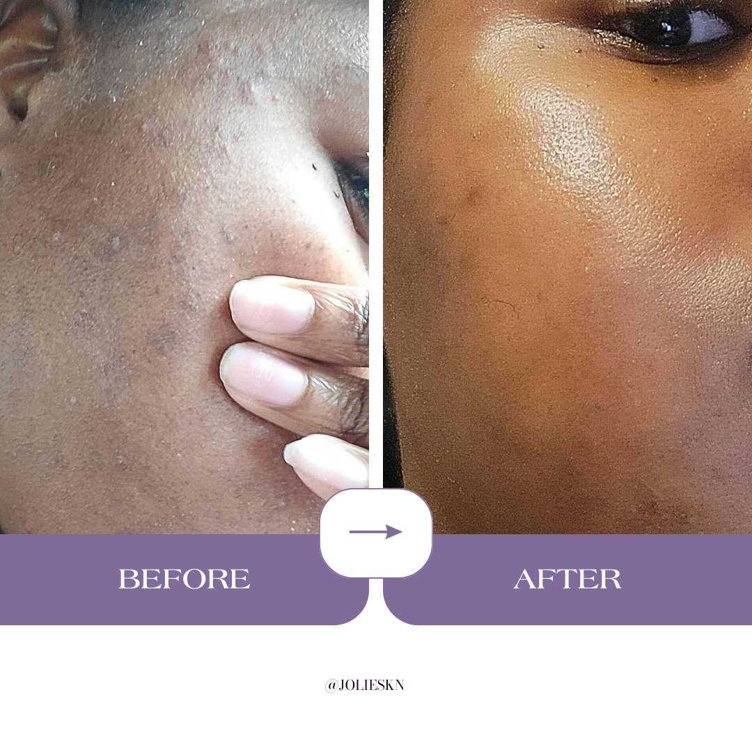 Vitamin C Gel Cleanser