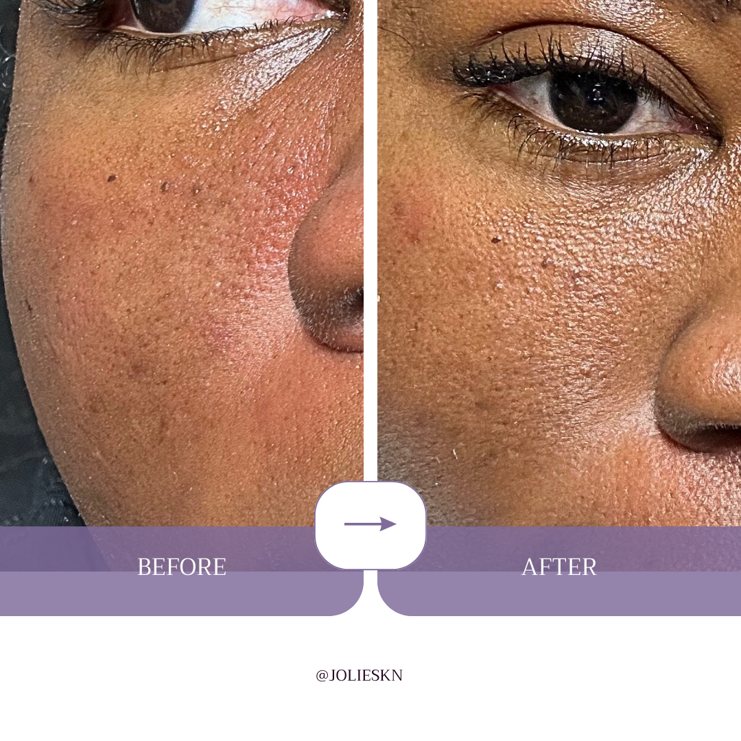 Gingko Biloba Hydrating Toner - JolieSKN