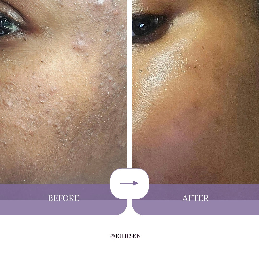 Vitamin C Gel Cleanser - JolieSKN