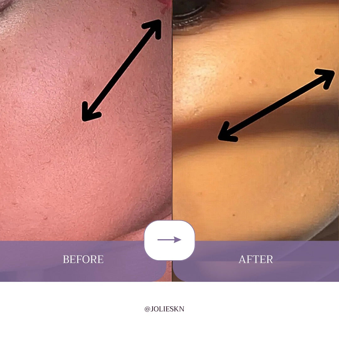 AHA + BHA Exfoliating Gel Cleanser - JolieSKN