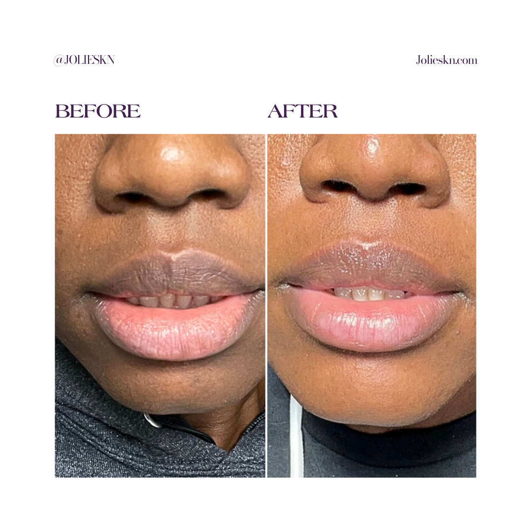 Vitamin C + Amino Acids Serum - JolieSKN