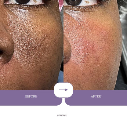 Vitamin C + Amino Acids Serum - JolieSKN