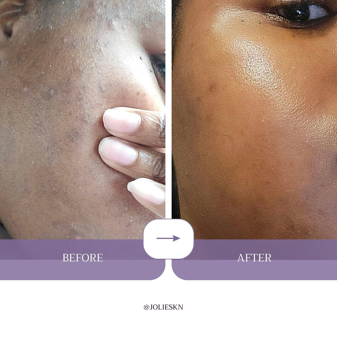 Vitamin C Gel Cleanser - JolieSKN