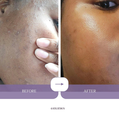 Vitamin C Gel Cleanser - JolieSKN