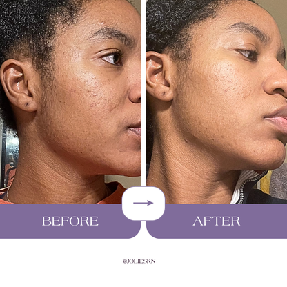 Vitamin C + Amino Acids Serum