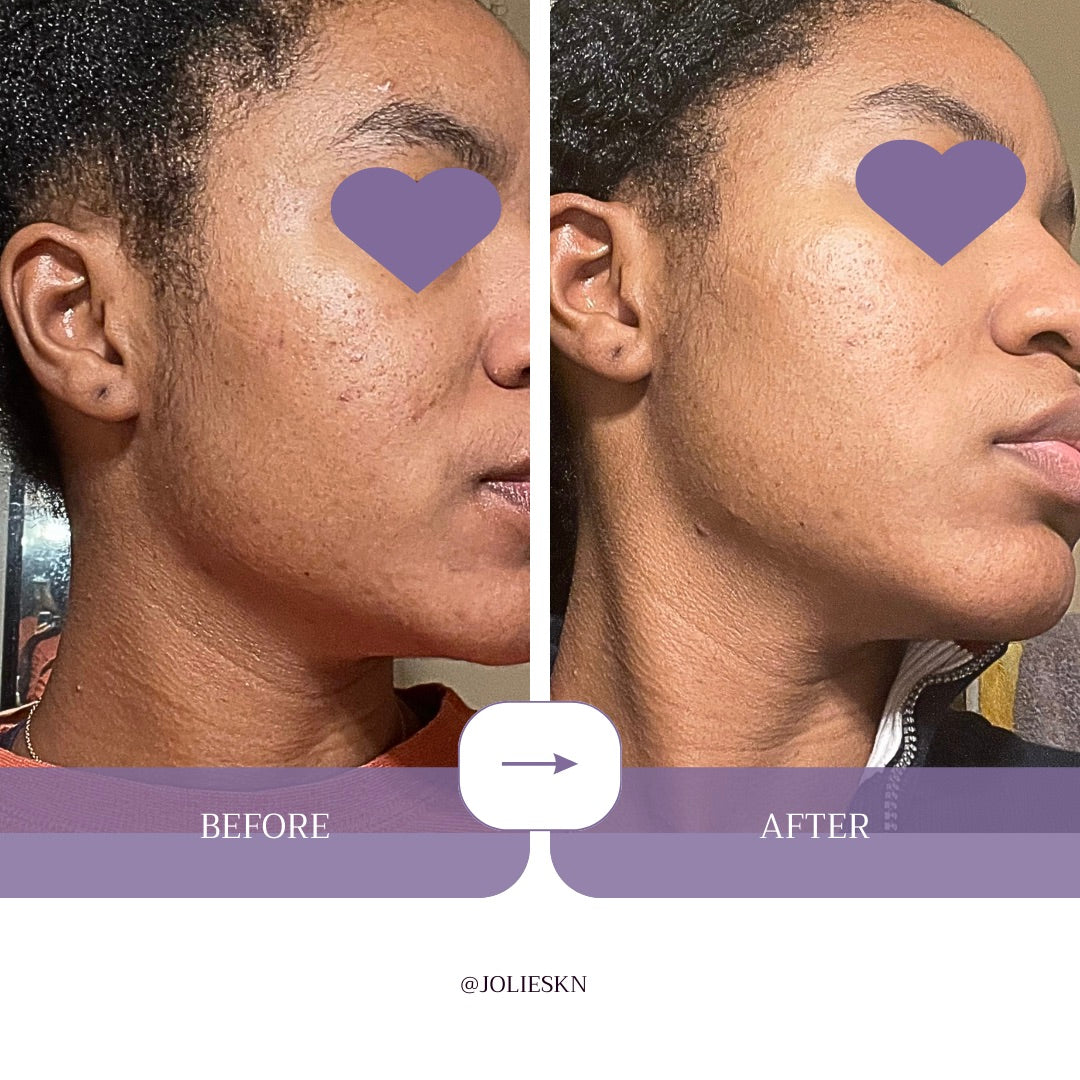 Vitamin C + Amino Acids Serum - JolieSKN