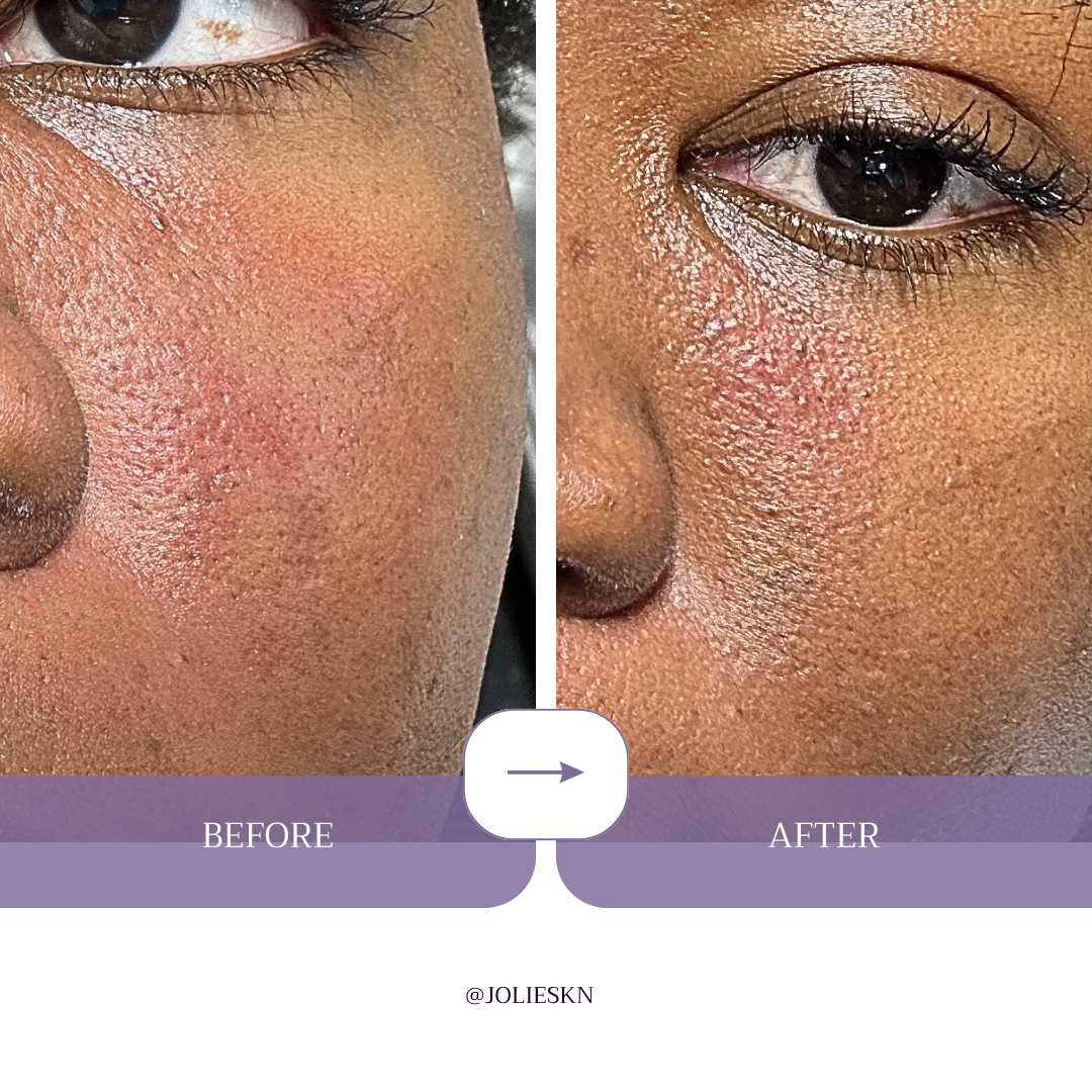 Gingko Biloba Hydrating Toner - JolieSKN