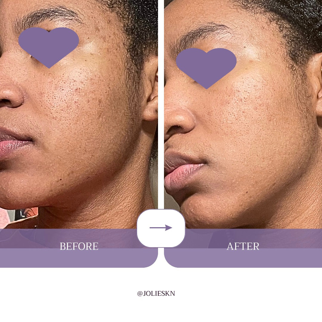 Vitamin C + Amino Acids Serum - JolieSKN