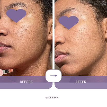 Vitamin C + Amino Acids Serum - JolieSKN