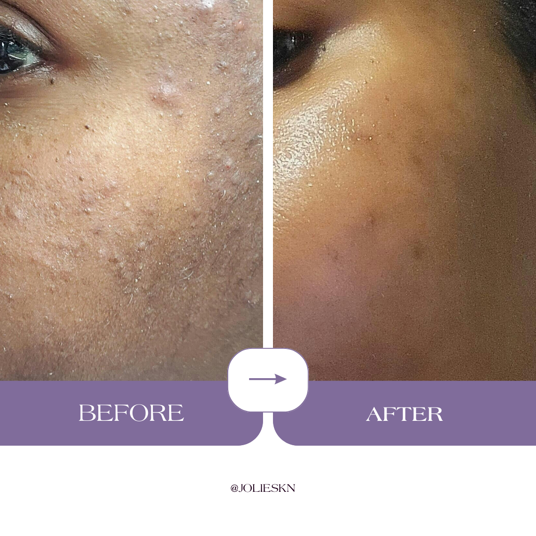 Vitamin C Gel Cleanser