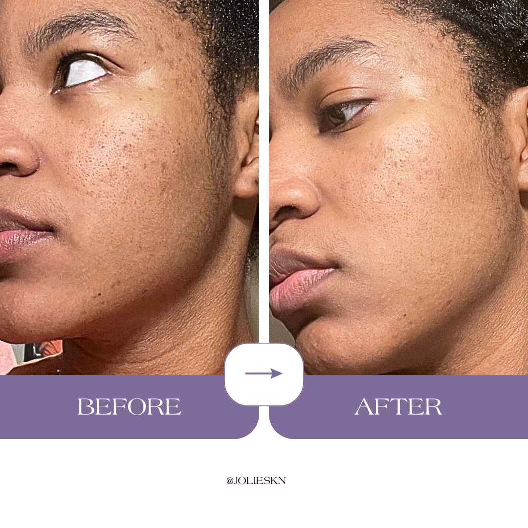 Vitamin C + Amino Acids Serum