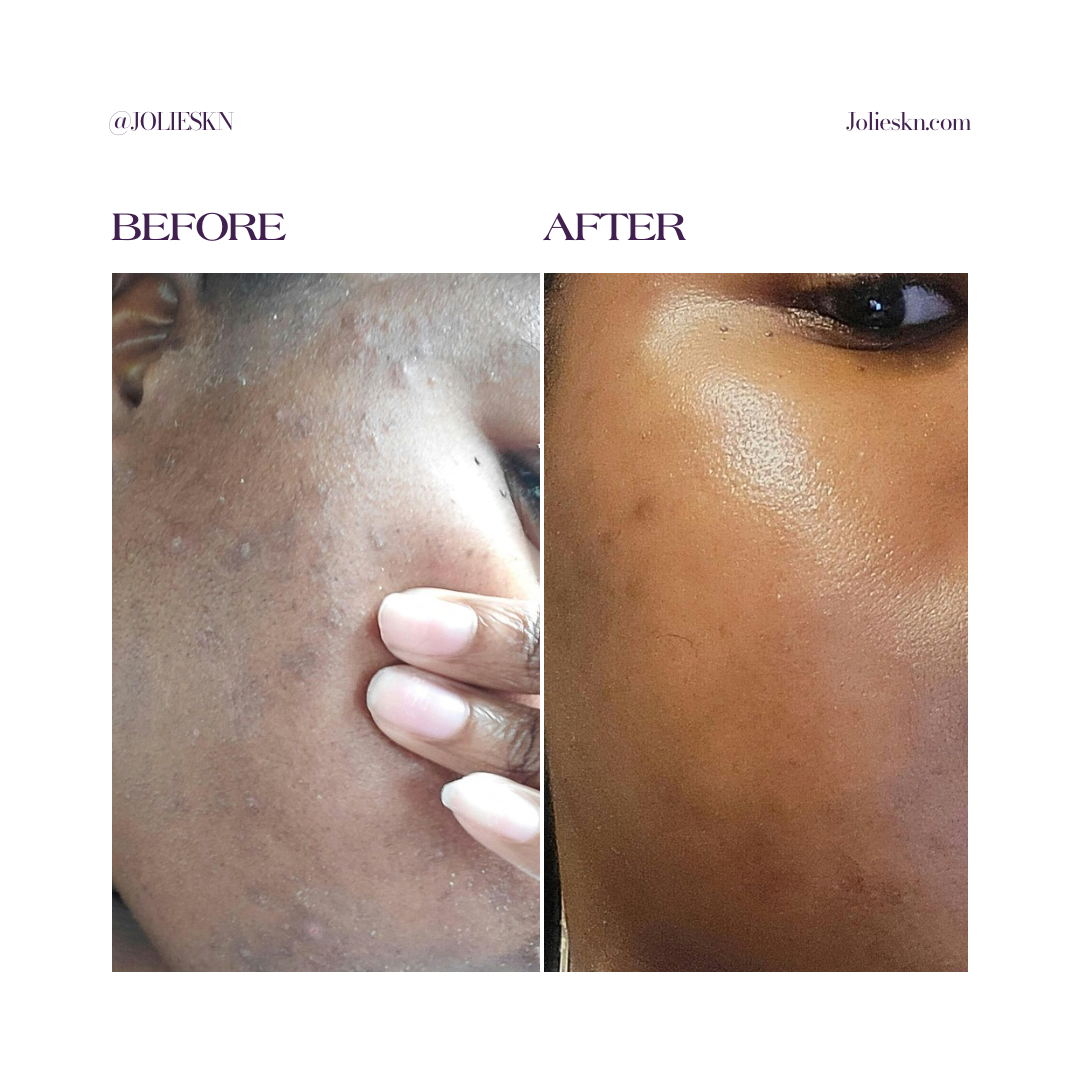 Vitamin C Gel Cleanser - JolieSKN
