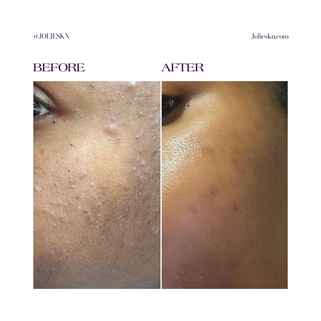 Vitamin C Gel Cleanser - JolieSKN