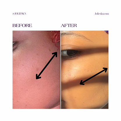 AHA + BHA Exfoliating Gel Cleanser - JolieSKN